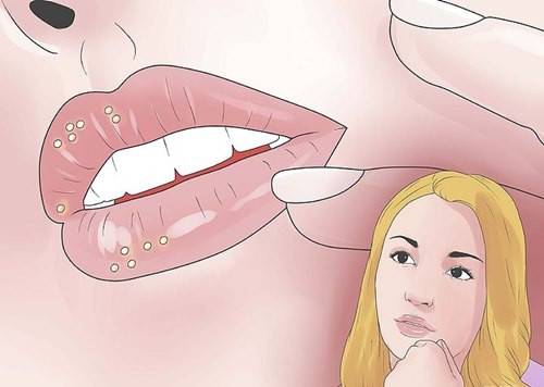 Dấu hiệu nhận biết bệnh giang mai