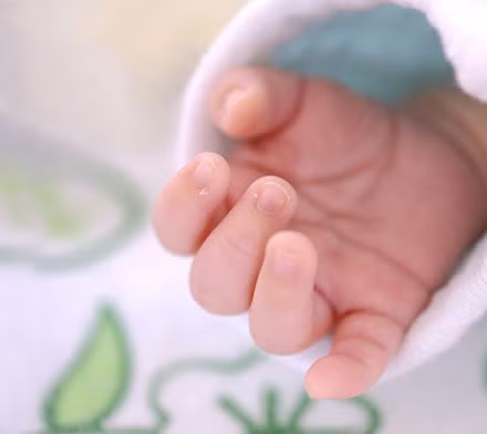 Nhìn tay đoán tín hiệu sức khỏe của trẻ sơ sinh