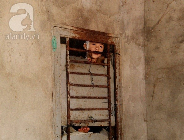 Cuộc sống như “tù ngục” của bé mồ côi mắc u não Cuộc sống như “tù ngục” của bé mồ côi mắc u não