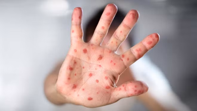 Ảnh minh họa/internet