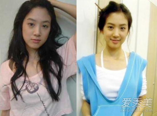 Jung Ryeo Won phẫu thuật thẩm mỹ Jung Ryeo Won phẫu thuật thẩm mỹ
