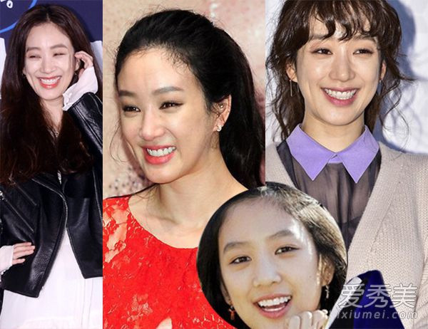 Jung Ryeo Won phẫu thuật thẩm mỹ Jung Ryeo Won phẫu thuật thẩm mỹ