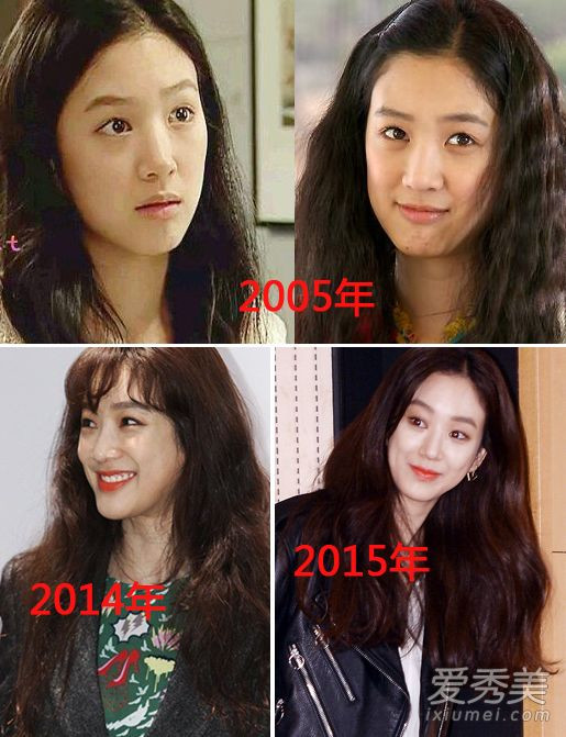 Jung Ryeo Won phẫu thuật thẩm mỹ Jung Ryeo Won phẫu thuật thẩm mỹ