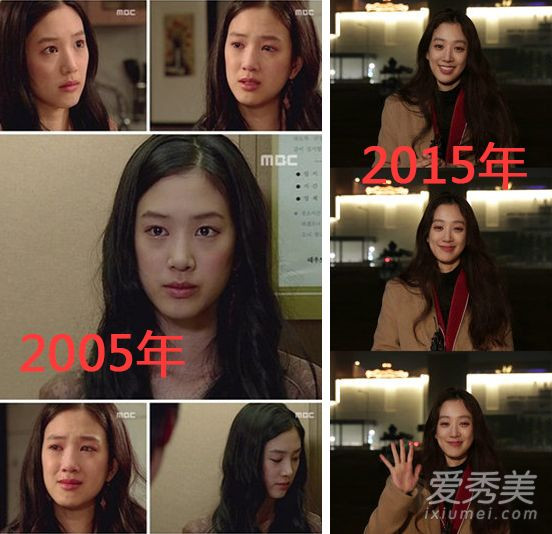 Jung Ryeo Won phẫu thuật thẩm mỹ Jung Ryeo Won phẫu thuật thẩm mỹ
