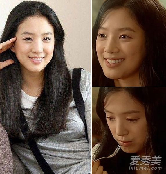 Jung Ryeo Won phẫu thuật thẩm mỹ Jung Ryeo Won phẫu thuật thẩm mỹ