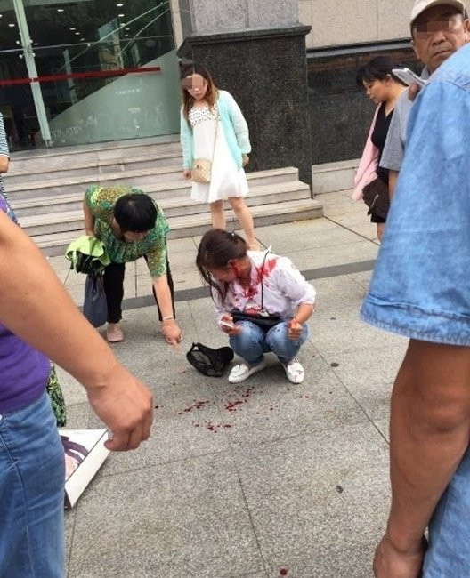 Phẫn nộ chàng trai cắn đứt tai bạn gái vì mâu thuẫn - Ảnh 2 Phẫn nộ chàng trai cắn đứt tai bạn gái vì mâu thuẫn - Ảnh 2