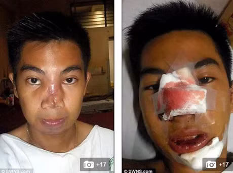 Nang mui voi gia 250 ngan dong, chang trai phai chiu bien chung kinh hoang - Anh 4