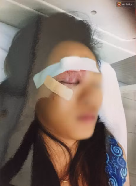 Nguoi ban hang rong hoang so nho lai giay phut bi 20 thanh nien truy sat o Sai Gon - Anh 1