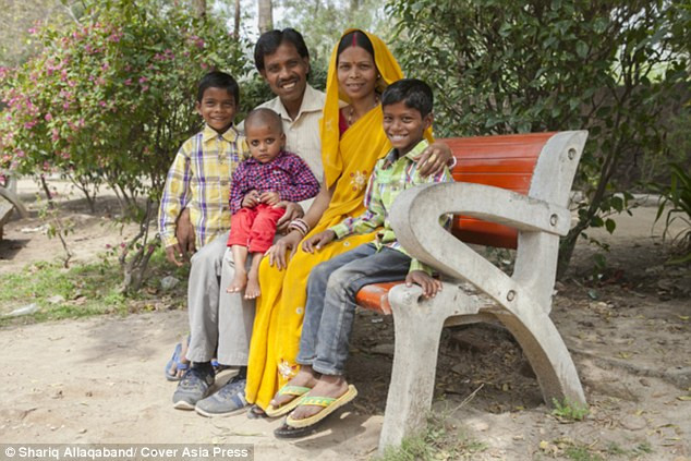 hội chứng, phẫu thuật, x-quang, Ấn Độ, tóc, ăn, tiến sĩ, bệnh viện, khoa nhi, chẩn đoán