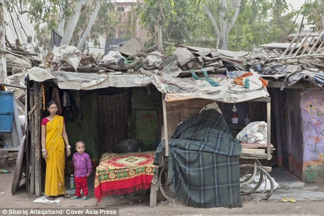 hội chứng, phẫu thuật, x-quang, Ấn Độ, tóc, ăn, tiến sĩ, bệnh viện, khoa nhi, chẩn đoán