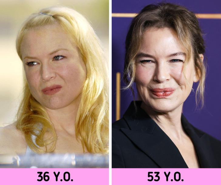 Renee Zellweger.