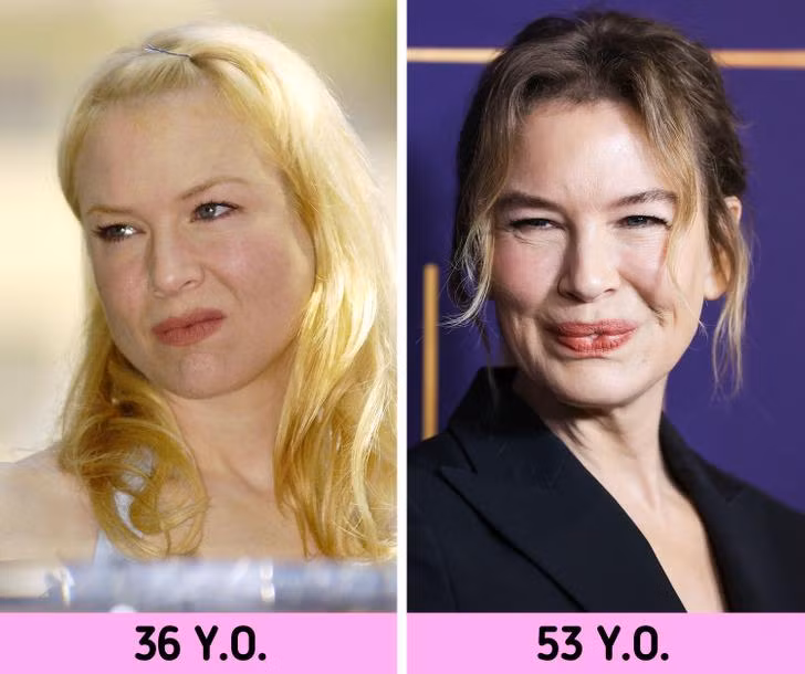 Renee Zellweger.