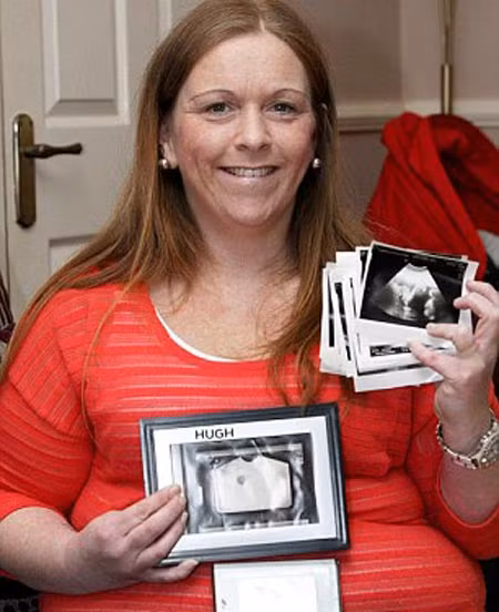 Mẹ 2 âm đạo, 2 tử cung sinh con kỳ diệu ảnh 1 Mẹ 2 âm đạo, 2 tử cung sinh con kỳ diệu - 1