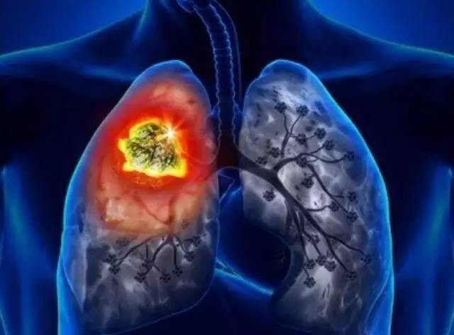 5 thứ mà nội tạng sợ nhất nhưng bạn đang “thản nhiên” nạp vào cơ thể hằng ngày ảnh 2