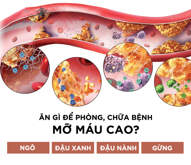 Không phải thuốc hay cao lương mĩ vị, 4 món dân dã này sẽ “đánh bật” bệnh mỡ máu cao