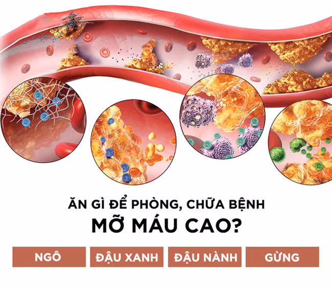 Không phải thuốc hay cao lương mĩ vị, 4 món dân dã này sẽ “đánh bật” bệnh mỡ máu cao