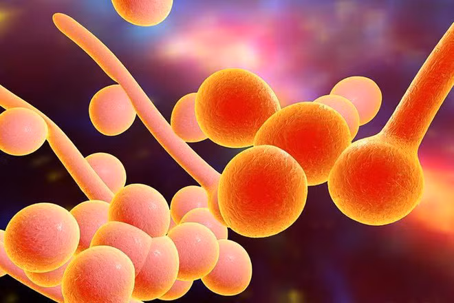 7 nguyên nhân gây ngứa ở mông rất có thể nghiêm trọng hơn bạn nghĩ ảnh 2