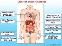 Có 6 giờ để cứu bộ não, nhưng chỉ có 60 phút để cứu quả tim