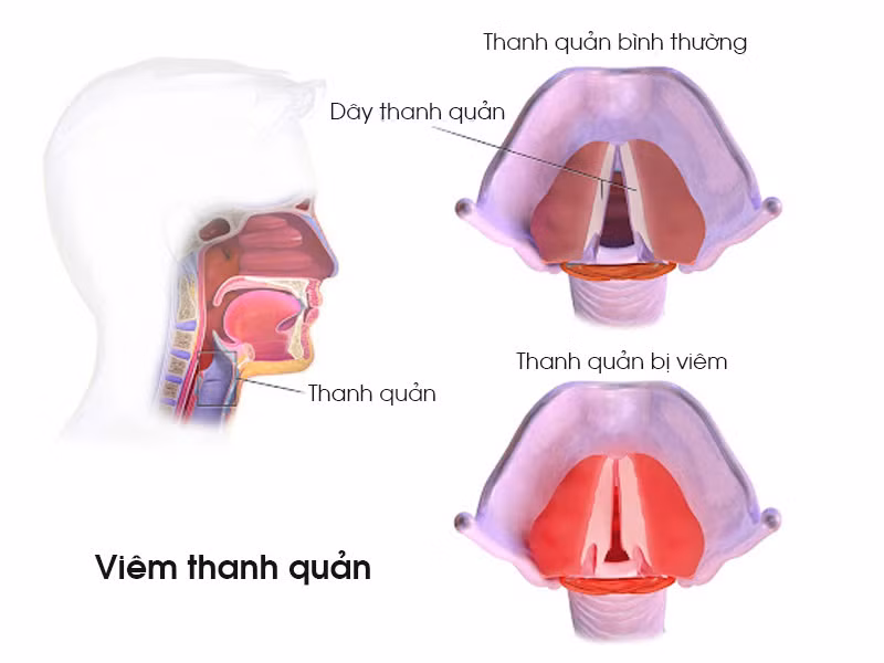 Cấu tạo thanh quản trong cổ họng
