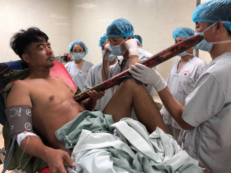 Bệnh nhân nhập viện với thanh sắt dài 2m trên ngực trái.