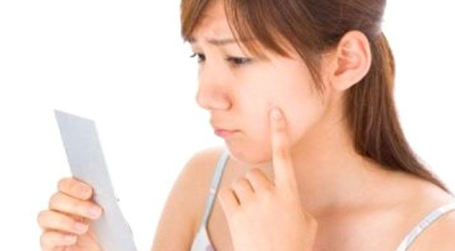 Cách đơn giản để ngăn ngừa mụn