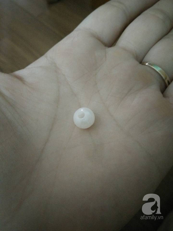 Khi trẻ có dị vật trong tai, mũi, thao tác xử lý bố mẹ cần biết ảnh 1