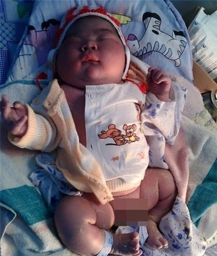 em bé, nặng, 6,1kg, Nam Định