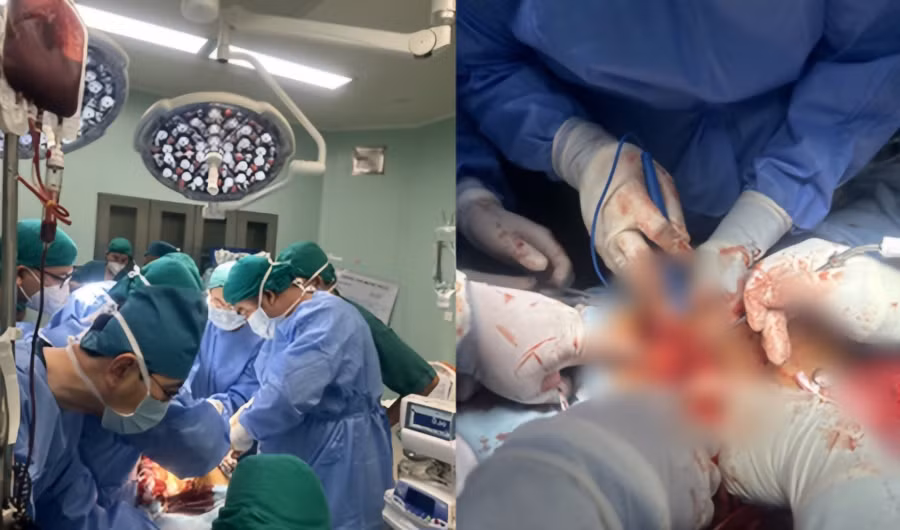 Một nam thanh niên bị đâm lủng gan, lủng phổi được kích hoạt quy trình “báo động đỏ” liên viện để cấp cứu. 