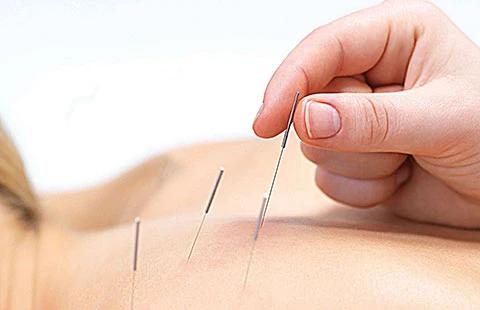 Châm cứu sao cho vừa ít kim châm vừa ít đau thì mới là thầy thuốc giỏi.