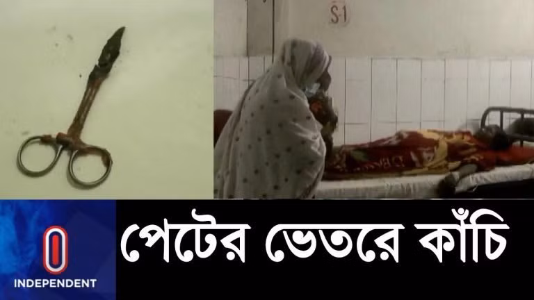 Chiếc kéo phẫu thuật được lấy ra khỏi cơ thể người phụ nữ sau 20 năm.