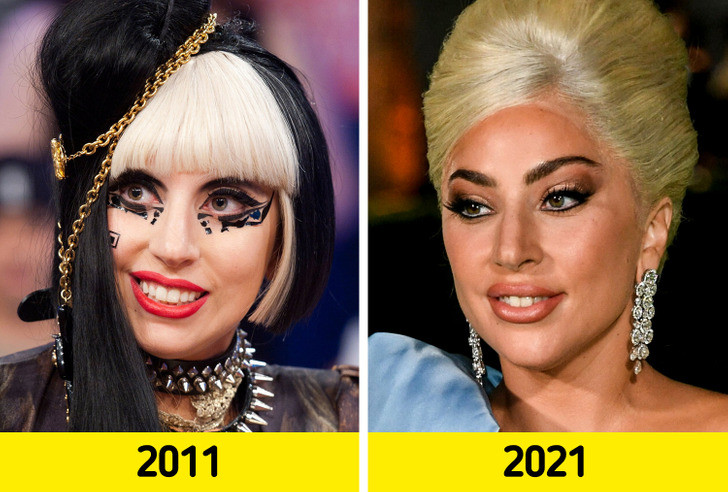 Lady Gaga.