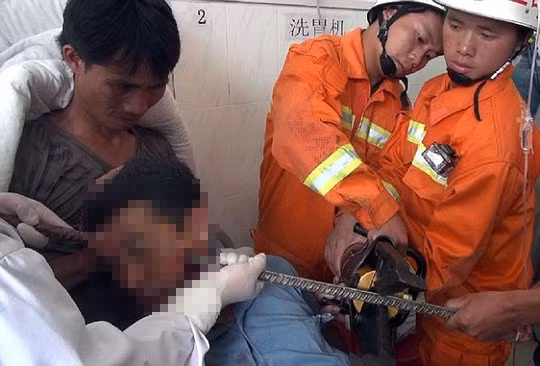 TẾTXONGOK Kinh hoàng những trường hợp bị vật nhọn đâm sâu vào cơ thể