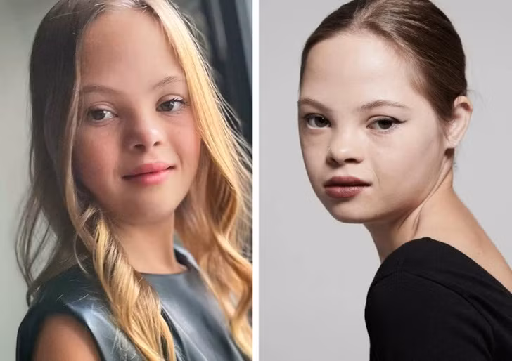 Cô bé mắc hội chứng Down giờ đây đã trở thành ngôi sao Hollywood.