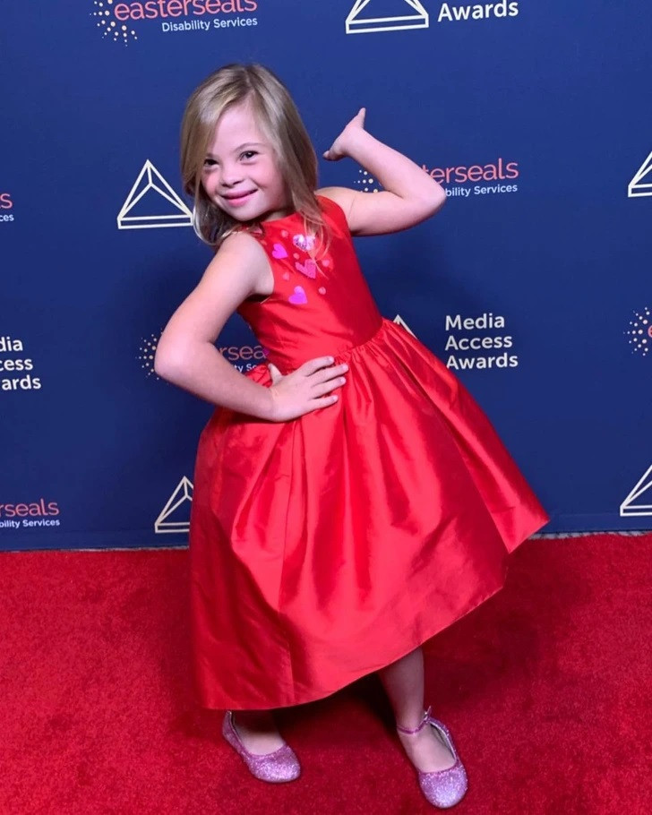 Cô bé mắc hội chứng Down bị bỏ rơi từ khi mới sinh đã trở thành người truyền cảm hứng.