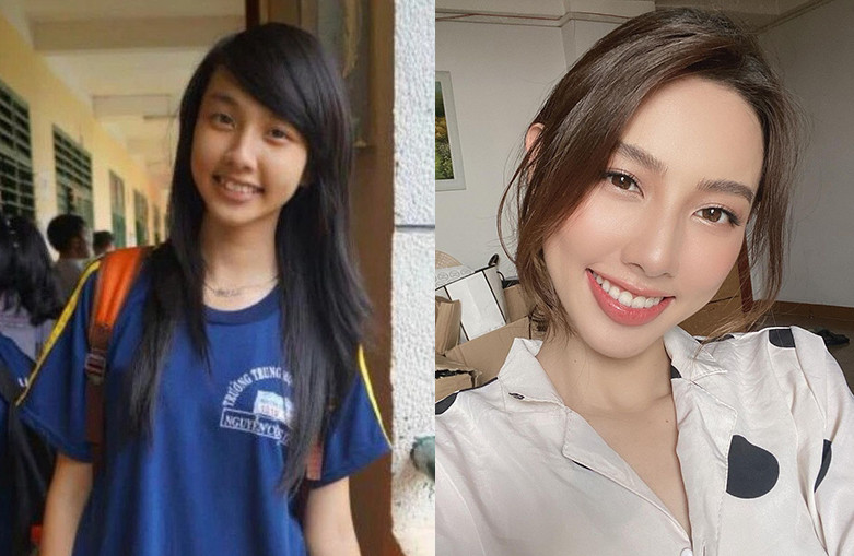 Nhờ việc niềng răng và cắt nướu, Thùy Tiên có nụ cười tươi sáng, rạng ngời hơn.