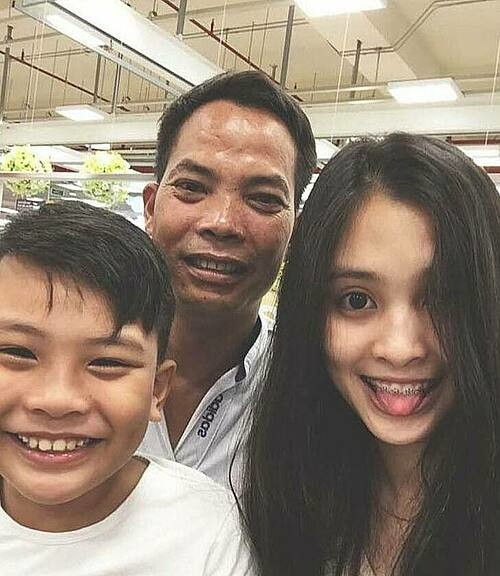 Hoa hậu Tiểu Vy từng niềng răng thời cấp 3, nhờ vậy khi thi Hoa hậu Việt Nam 2018 cô đã có nụ cười trắng sáng hoàn hảo.