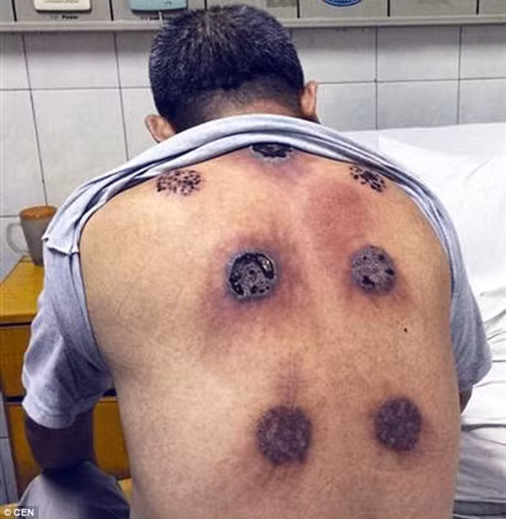Giac hoi chua benh sai cach va hau qua khung khiep - Anh 1