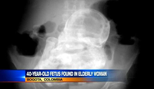 nhung ba me ky la nhat hanh tinh hinh anh 7