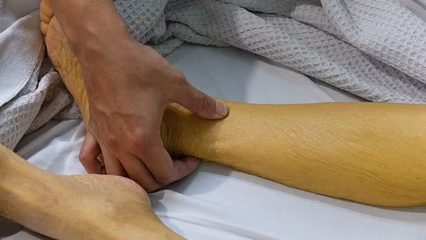 9 dấu hiệu ai cũng nghĩ chỉ là bệnh vặt mà không ngờ đó có thể là biểu hiện của bệnh ung thư tuyến tụy nguy hiểm-2