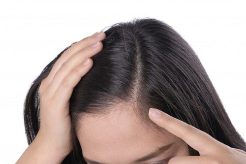 mua khe ve ep lay nuoc goi dau, sau 1 tuan bao nhieu gau cung bien mat, toc het rung - 8