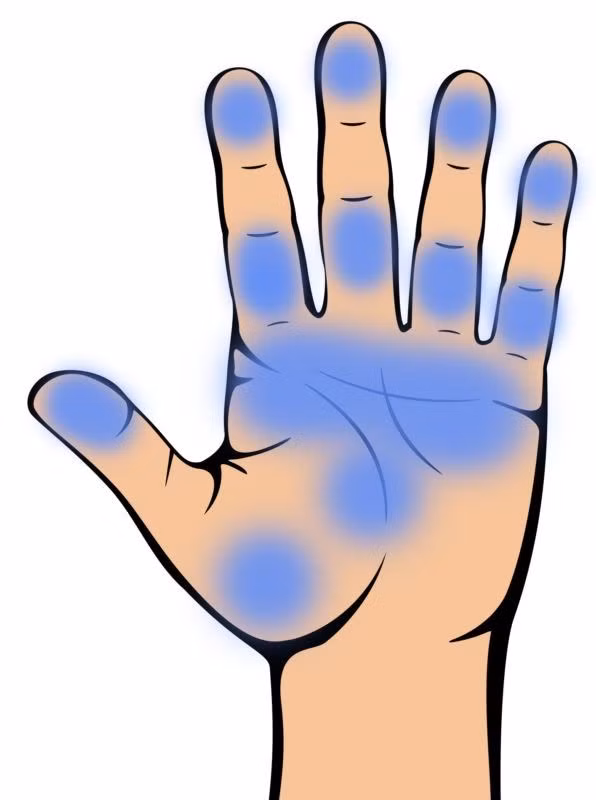 bestie nhung bieu hien o ban tay canh bao suc khoe