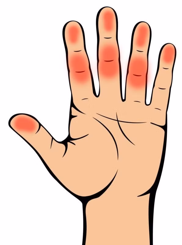 bestie nhung bieu hien o ban tay canh bao suc khoe