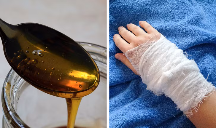 chữa lành vết thương bằng mật ong