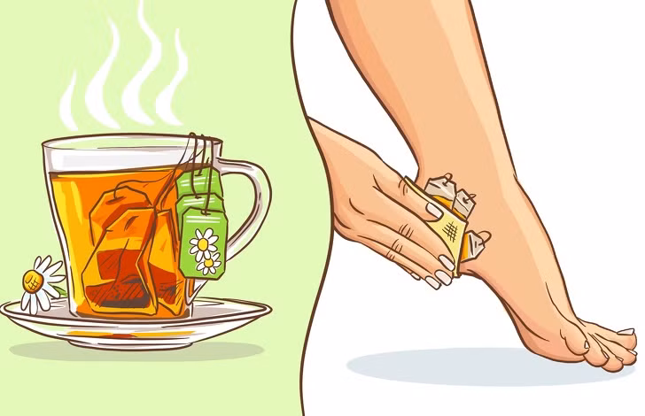 trà hoa cúc trị phồng rộp gót chân