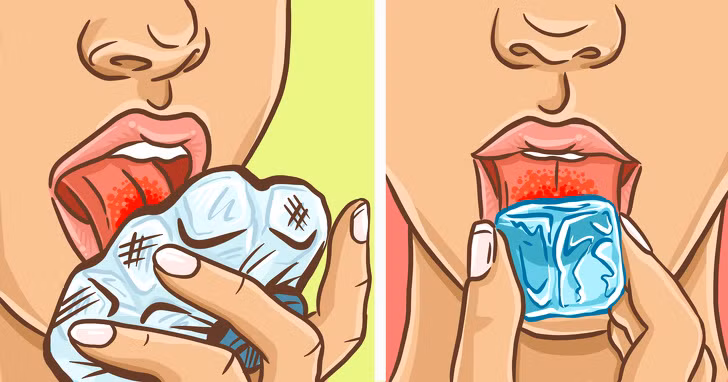 dùng đá lạnh trị bỏng