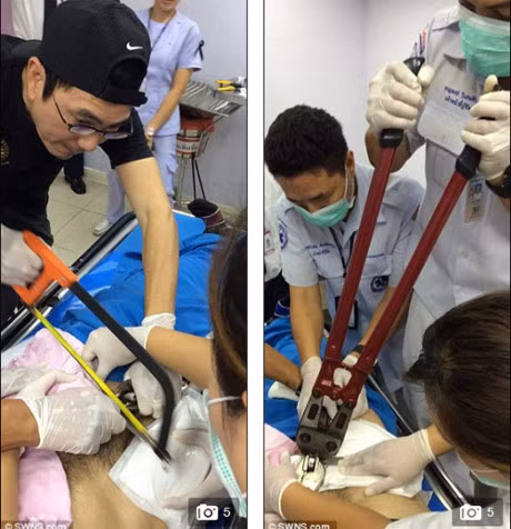 Chang trai TQ bi mac ket chiec dua dai trong 