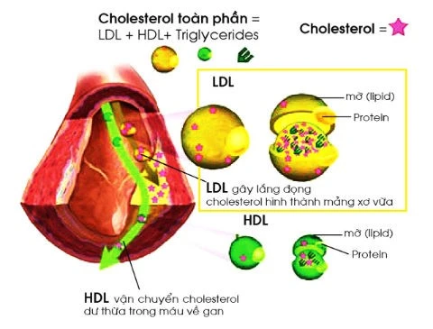 Một nghiên cứu mới đây đăng trên tạp chí European Heart cho thấy, điều hòa tốt cholesterol sẽ làm giảm được 74% nguy cơ nhồi máu cơ tim.