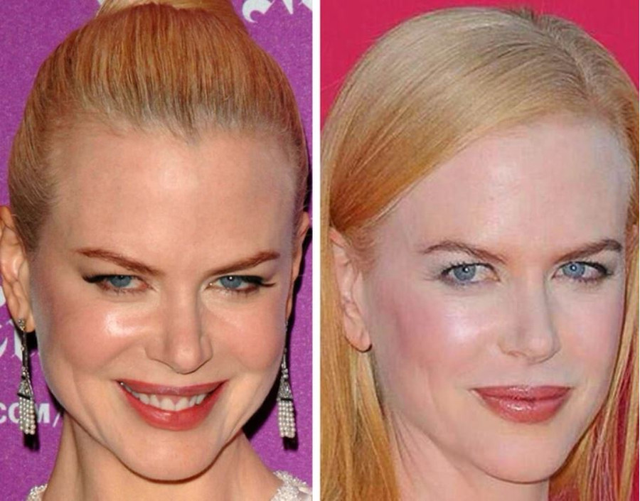 Nữ diễn viên Nicole Kidman. Nữ diễn viên Nicole Kidman.
