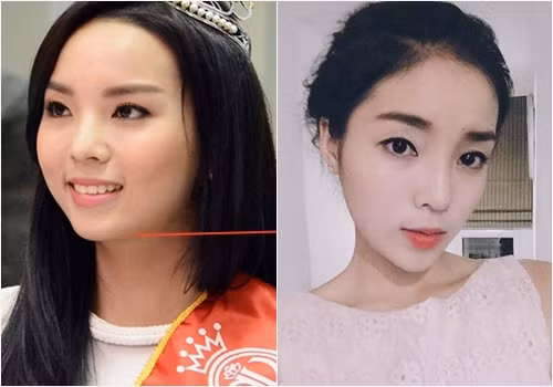 Lý do Hoa hậu Kỳ Duyên không phẫu thuật gọt mặt, độn cằm mà vẫn đẹp - Ảnh 1