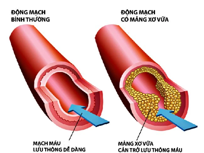 Nếu biết công thức này, cao huyết áp, rối loạn tiền đình và mỡ máu chẳng có gì đáng sợ